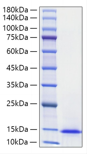Recombinant Mouse Midkine/MDK Protein (RPCB2187)