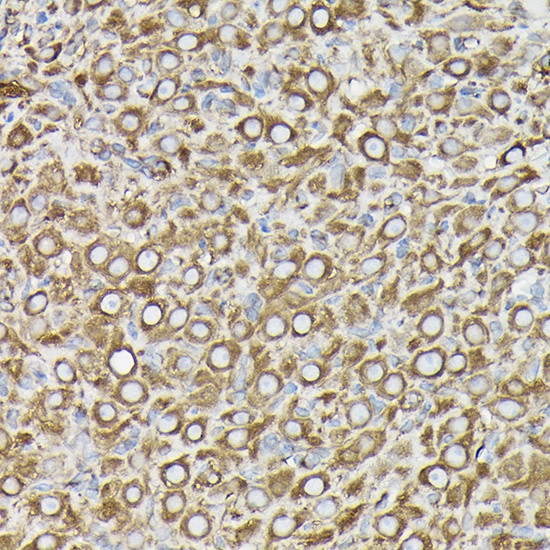 Immunohistochemistry analysis of paraffin-embedded Rat ovary using β-Tubulin Mouse mAb (CABC021) at dilution of 1:100 (40x lens). High pressure antigen retrieval performed with 0.01M Citrate buffer (pH 6.0) prior to IHC staining.