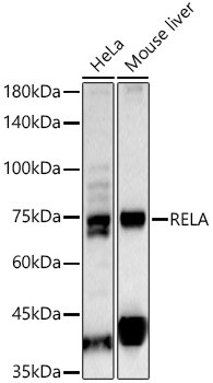 Anti-RELA Polyclonal Antibody (CAB22676)