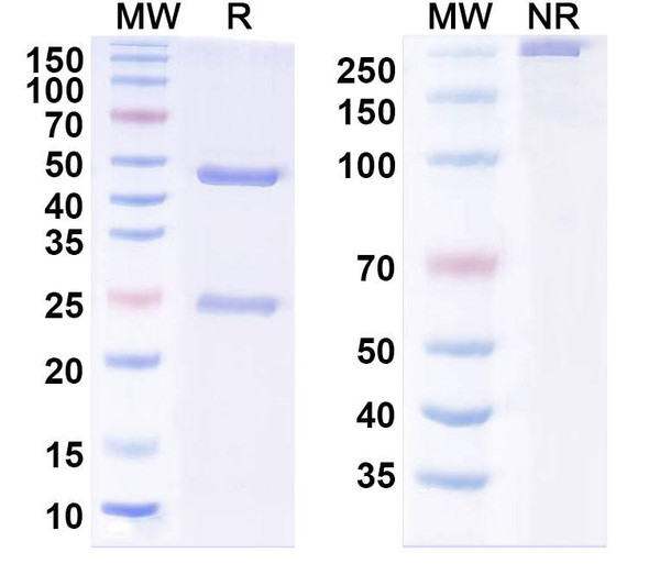 Anti-Trastuzumab Idiotypic Antibody [SAA2113]