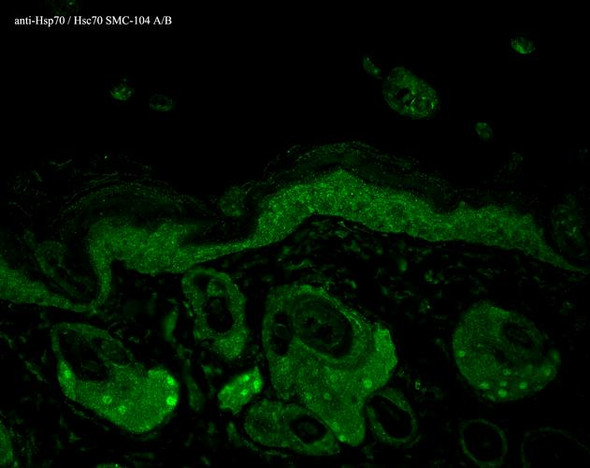 Immunohistochemistry analysis using Mouse Anti-Hsp70 Monoclonal Antibody, Clone N27F3-4 (STMA00002). Tissue: backskin. Species: Mouse. Fixation: Bouin's Fixative and paraffin-embedded. Primary Antibody: Mouse Anti-Hsp70 Monoclonal Antibody (STMA00002) at 1:100 for 1 hour at RT. Secondary Antibody: FITC Goat Anti-Mouse (green) at 1:50 for 1 hour at RT. Localization: Epidermis.