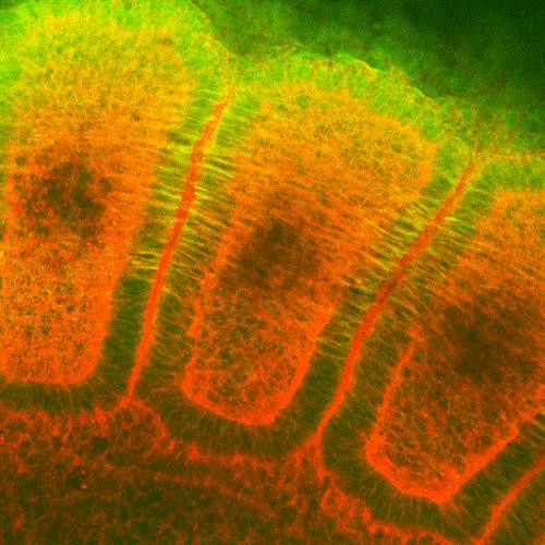 Immunohistochemistry analysis using Mouse Anti-Hsp27 Monoclonal Antibody, Clone 8A7 (STMA00010). Tissue: embryo somites. Species: Rat. Primary Antibody: Mouse Anti-Hsp27 Monoclonal Antibody (STMA00010) at 1:1000. Secondary Antibody: FITC Goat Anti-Mouse (green). Counterstain: Rhodamine-phalloidin labeled actin (red). Investigation at 11 days gestation. Courtesy of: Mike Welsh, Umich.
