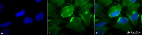 Immunocytochemistry/Immunofluorescence analysis using Mouse Anti-CD74 Monoclonal Antibody, Clone PIN 1.1 (STMA00011). Tissue: Cervical cancer cell line (HeLa). Species: Human. Fixation: 2% Formaldehyde for 20 min at RT. Primary Antibody: Mouse Anti-CD74 Monoclonal Antibody (STMA00011) at 1:100 for 12 hours at 4°C. Secondary Antibody: FITC Goat Anti-Mouse (green) at 1:200 for 2 hours at RT.