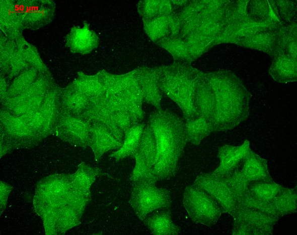 Immunocytochemistry/Immunofluorescence analysis using Mouse Anti-PSD95 Monoclonal Antibody, Clone 7E3 (STMA00014). Tissue: HaCaT cells. Species: Human. Fixation: Cold 100% methanol for 10 minutes at -20°C. Primary Antibody: Mouse Anti-PSD95 Monoclonal Antibody (STMA00014) at 1:100 for 1 hour at RT. Secondary Antibody: FITC Goat Anti-Mouse (green) at 1:50 for 1 hour at RT. Localization: Filamentous-like staining.