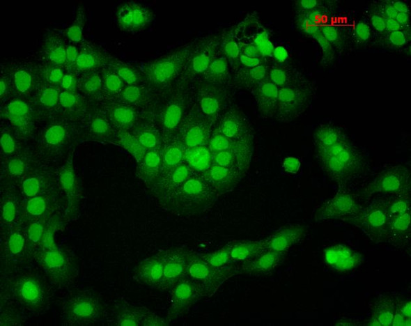 Immunocytochemistry/Immunofluorescence analysis using Mouse Anti-CaMKII Monoclonal Antibody, Clone 6G9 (STMA00015). Tissue: HaCaT cells. Species: Human. Fixation: Cold 100% methanol for 10 minutes at -20°C. Primary Antibody: Mouse Anti-CaMKII Monoclonal Antibody (STMA00015) at 1:100 for 1 hour at RT. Secondary Antibody: FITC Goat Anti-Mouse (green) at 1:50 for 1 hour at RT. Localization: Nuclear Staining.