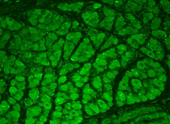 Immunohistochemistry analysis using Mouse Anti-CaMKII Monoclonal Antibody, Clone 22B1 (STMA00016). Tissue: backskin. Species: Mouse. Fixation: Bouin's Fixative and paraffin-embedded. Primary Antibody: Mouse Anti-CaMKII Monoclonal Antibody (STMA00016) at 1:100 for 1 hour at RT. Secondary Antibody: FITC Goat Anti-Mouse (green) at 1:50 for 1 hour at RT. Localization: Muscle, hair follicle, epidermis. Backskin obtained from transgenic mice.