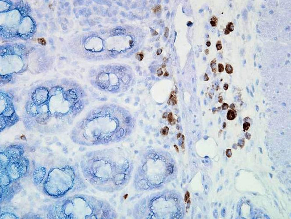 Immunohistochemistry analysis using Mouse Anti-Hsp90 Monoclonal Antibody, Clone D7alpha (STMA00020). Tissue: inflamed colon. Species: Mouse. Fixation: Formalin. Primary Antibody: Mouse Anti-Hsp90 Monoclonal Antibody (STMA00020) at 1:100000 for 12 hours at 4°C. Secondary Antibody: Biotin Goat Anti-Mouse at 1:2000 for 1 hour at RT. Counterstain: Mayer Hematoxylin (purple/blue) nuclear stain at 200 µl for 2 minutes at RT.