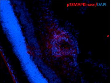 Immunohistochemistry analysis using Mouse Anti-p38 MAPK Monoclonal Antibody, Clone 9F12 (STMA00031). Tissue: Retinal Injury Model. Species: Mouse. Primary Antibody: Mouse Anti-p38 MAPK Monoclonal Antibody (STMA00031) at 1:1000. Secondary Antibody: Alexa Fluor 594 Goat Anti-Mouse (red). Courtesy of: Dr. Rajashekhar Gangaraju, University of Indiana, Department of Ophthalmology, Eugene and Marilyn Glick Eye Institute.