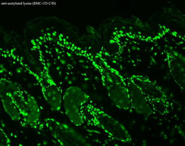 Immunohistochemistry analysis using Mouse Anti-Acetylated Lysine Monoclonal Antibody, Clone 7F8 (STMA00032). Tissue: backskin. Species: Mouse. Fixation: Bouin's Fixative and paraffin-embedded. Primary Antibody: Mouse Anti-Acetylated Lysine Monoclonal Antibody (STMA00032) at 1:100 for 1 hour at RT. Secondary Antibody: FITC Goat Anti-Mouse (green) at 1:50 for 1 hour at RT. Backskin obtained from transgenic mice.