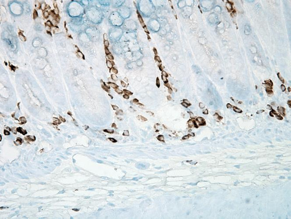 Immunohistochemistry analysis using Mouse Anti-Nitrotyrosine Monoclonal Antibody, Clone 39B6 (STMA00033). Tissue: inflamed colon. Species: Mouse. Fixation: Formalin. Primary Antibody: Mouse Anti-Nitrotyrosine Monoclonal Antibody (STMA00033) at 1:1000000 for 12 hours at 4°C. Secondary Antibody: Biotin Goat Anti-Mouse at 1:2000 for 1 hour at RT. Counterstain: Mayer Hematoxylin (purple/blue) nuclear stain at 200 µl for 2 minutes at RT.