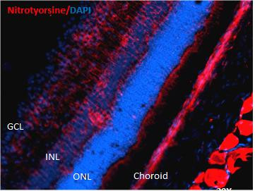 Immunohistochemistry analysis using Mouse Anti-Nitrotyrosine Monoclonal Antibody, Clone 39B6 (STMA00033). Tissue: Retinal Injury Model. Species: Mouse. Primary Antibody: Mouse Anti-Nitrotyrosine Monoclonal Antibody (STMA00033) at 1:1000. Secondary Antibody: Alexa Fluor 594 Goat Anti-Mouse (red). Courtesy of: Dr. Rajashekhar Gangaraju, University of Indiana, Department of Ophthalmology, Eugene and Marilyn Glick Eye Institute.