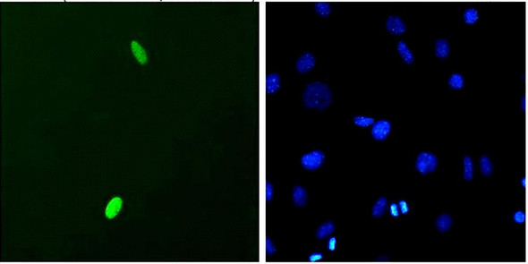 Immunocytochemistry/Immunofluorescence analysis using Mouse Anti-DUX4 Monoclonal Antibody, Clone P2B1 (STMA00052). Tissue: C2C12 myoblast cells. Species: Mouse. Primary Antibody: Mouse Anti-DUX4 Monoclonal Antibody (STMA00052) at 1:1000. Secondary Antibody: FITC Goat Anti-Mouse (green). Counterstain: DAPI (blue) nuclear stain. Cells transfected with pCS2+DUX4.