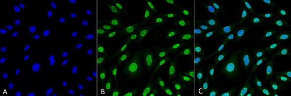Immunocytochemistry/Immunofluorescence analysis using Mouse Anti-HO-1 (Rat) Monoclonal Antibody, Clone 6B8-2F2 (STMA00068). Tissue: Fibroblast cell line (NIH 3T3). Species: Mouse. Fixation: 4% Formaldehyde for 15 min at RT. Primary Antibody: Mouse Anti-HO-1 (Rat) Monoclonal Antibody (STMA00068) at 1:100 for 60 min at RT. Secondary Antibody: Goat Anti-Mouse ATTO 488 at 1:100 for 60 min at RT.