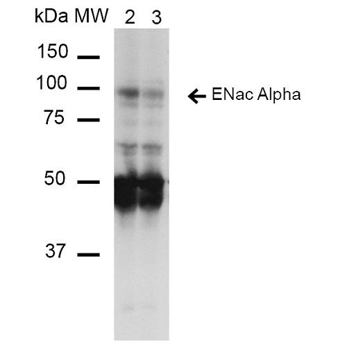 Western Blot analysis of Mouse Whole kidney homogenates showing detection of ~85kDa ENaC alpha protein using Mouse Anti-ENaC alpha Monoclonal Antibody, Clone 14E10 (STMA00071). Lane 1: Molecular Weight Ladder (MW). Lane 2: Low-salt diet. Lane 3: Normal-salt diet. Load: 20 µg. Primary Antibody: Mouse Anti-ENaC alpha Monoclonal Antibody (STMA00071) at 1:1000. Predicted/Observed Size: ~85kDa.