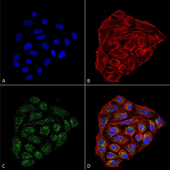 Immunocytochemistry/Immunofluorescence analysis using Mouse Anti-CD74 Monoclonal Antibody, Clone 1B8 (STMA00077). Tissue: Cervical cancer cell line (HeLa). Species: Human. Fixation: 4% Formaldehyde for 15 min at RT. Primary Antibody: Mouse Anti-CD74 Monoclonal Antibody (STMA00077) at 1:100 for 60 min at RT. Secondary Antibody: Goat Anti-Mouse ATTO 488 at 1:200 for 60 min at RT.