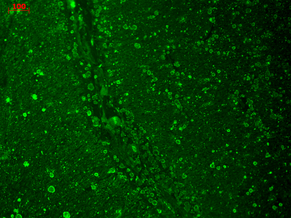 Immunohistochemistry analysis using Mouse Anti-CaV1.2 Calcium Channel Monoclonal Antibody, Clone S57 (STMA00080). Tissue: hippocampus. Species: Human. Fixation: 10% formalin. Primary Antibody: Mouse Anti-CaV1.2 Calcium Channel Monoclonal Antibody (STMA00080) at 1:100 for 1 hour at RT. Secondary Antibody: FITC Goat Anti-Mouse (green) at 1:50 for 1 hour at RT.