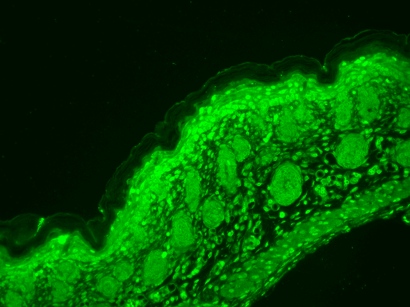 Immunohistochemistry analysis using Mouse Anti-CaV1.3 Calcium Channel Monoclonal Antibody, Clone S48 (STMA00081). Tissue: backskin. Species: Mouse. Fixation: Bouin's Fixative and paraffin-embedded. Primary Antibody: Mouse Anti-CaV1.3 Calcium Channel Monoclonal Antibody (STMA00081) at 1:100 for 1 hour at RT. Secondary Antibody: FITC Goat Anti-Mouse (green) at 1:50 for 1 hour at RT.