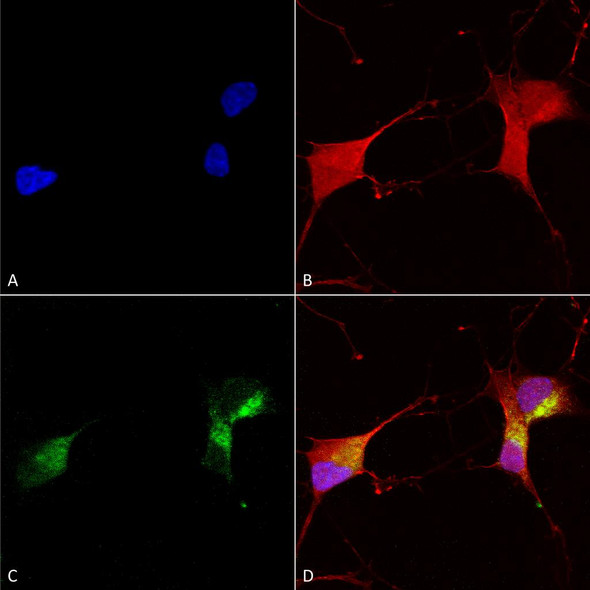 Immunocytochemistry/Immunofluorescence analysis using Mouse Anti-KCNQ1 Monoclonal Antibody, Clone N37A/10 (STMA00085). Tissue: Neuroblastoma cells (SH-SY5Y). Species: Human. Fixation: 4% PFA for 15 min. Primary Antibody: Mouse Anti-KCNQ1 Monoclonal Antibody (STMA00085) at 1:100 for overnight at 4°C with slow rocking. Secondary Antibody: AlexaFluor 488 at 1:1000 for 1 hour at RT.