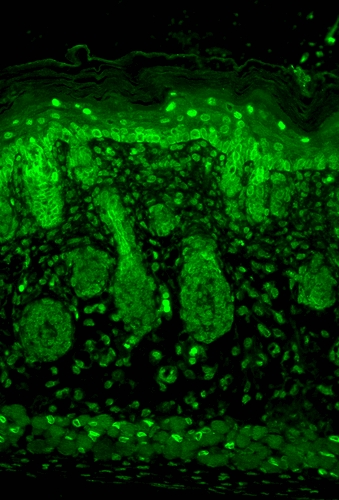 Immunohistochemistry analysis using Mouse Anti-Kir2.1 Potassium Channel Monoclonal Antibody, Clone S112 (STMA00087). Tissue: backskin. Species: Mouse. Fixation: Bouin's Fixative and paraffin-embedded. Primary Antibody: Mouse Anti-Kir2.1 Potassium Channel Monoclonal Antibody (STMA00087) at 1:100 for 1 hour at RT. Secondary Antibody: FITC Goat Anti-Mouse (green) at 1:50 for 1 hour at RT.