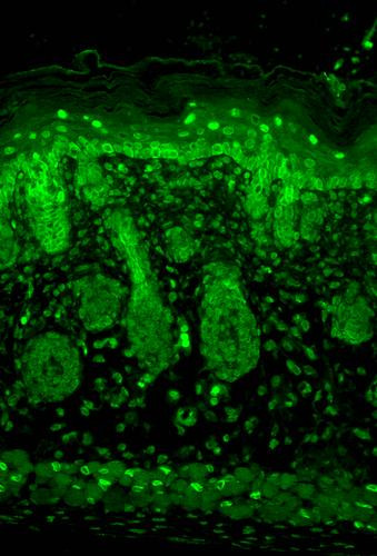 Immunohistochemistry analysis using Mouse Anti-Kir2.1 Potassium Channel Monoclonal Antibody, Clone S112 (STMA00087). Tissue: backskin. Species: Mouse. Fixation: Bouin's Fixative and paraffin-embedded. Primary Antibody: Mouse Anti-Kir2.1 Potassium Channel Monoclonal Antibody (STMA00087) at 1:100 for 1 hour at RT. Secondary Antibody: FITC Goat Anti-Mouse (green) at 1:50 for 1 hour at RT.