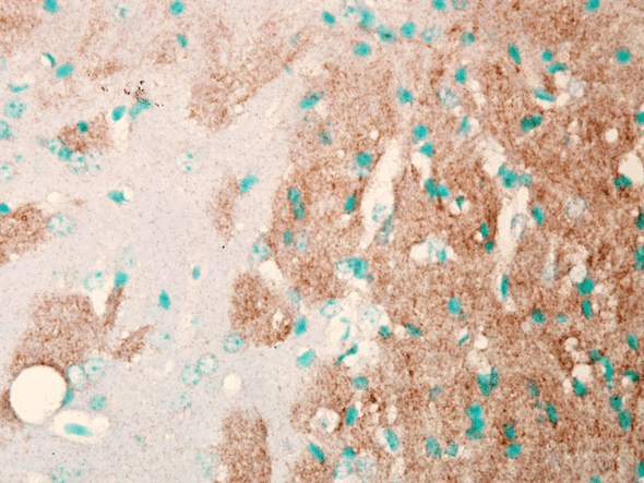 Immunohistochemistry analysis using Mouse Anti-Nav1.7 Sodium Channel Monoclonal Antibody, Clone N68/6 (STMA00088). Tissue: Brain Slice. Species: Mouse. Fixation: Frozen sections. Primary Antibody: Mouse Anti-Nav1.7 Sodium Channel Monoclonal Antibody (STMA00088) at 1:1000. Secondary Antibody: HRP/DAB Detection System: Biotinylated Goat Anti-Mouse, Streptavidin Peroxidase, DAB Chromogen (brown).