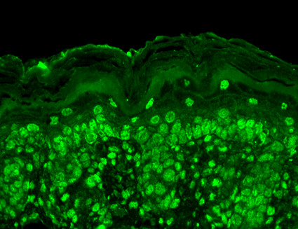 Immunohistochemistry analysis using Mouse Anti-Cav Beta2 Calcium Channel Monoclonal Antibody, Clone S8b-1 (STMA00095). Tissue: backskin. Species: Mouse. Fixation: Bouin's Fixative and paraffin-embedded. Primary Antibody: Mouse Anti-Cav Beta2 Calcium Channel Monoclonal Antibody (STMA00095) at 1:100 for 1 hour at RT. Secondary Antibody: FITC Goat Anti-Mouse (green) at 1:50 for 1 hour at RT. Localization: All nuclei.
