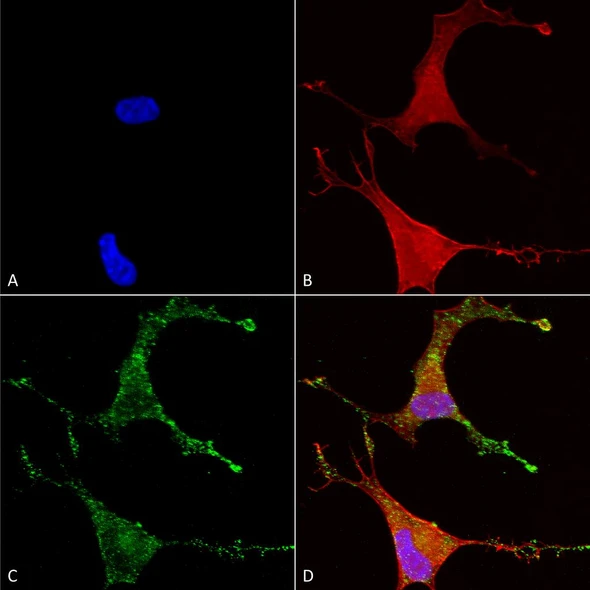 Immunocytochemistry/Immunofluorescence analysis using Mouse Anti-Cav beta 2 Monoclonal Antibody, Clone S8B-1 (STMA00095). Tissue: Neuroblastoma cells (SH-SY5Y). Species: Human. Fixation: 4% PFA for 15 min. Primary Antibody: Mouse Anti-Cav beta 2 Monoclonal Antibody (STMA00095) at 1:50 for overnight at 4°C with slow rocking. Secondary Antibody: AlexaFluor 488 at 1:1000 for 1 hour at RT.