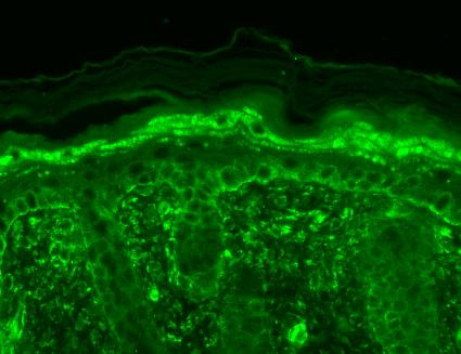 Immunohistochemistry analysis using Mouse Anti-TrpV3 Monoclonal Antibody, Clone S15-39 (STMA00096). Tissue: backskin. Species: Mouse. Fixation: Bouin's Fixative and paraffin-embedded. Primary Antibody: Mouse Anti-TrpV3 Monoclonal Antibody (STMA00096) at 1:100 for 1 hour at RT. Secondary Antibody: FITC Goat Anti-Mouse (green) at 1:50 for 1 hour at RT. Localization: Filaggrin-like staining in upper layers. Dull lower layer cell staining.