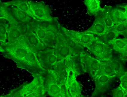 Immunocytochemistry/Immunofluorescence analysis using Mouse Anti-GluN2B Monoclonal Antibody, Clone S59-36 (STMA00098). Tissue: HaCaT cells. Species: Human. Fixation: Cold 100% methanol for 10 minutes at -20°C. Primary Antibody: Mouse Anti-GluN2B Monoclonal Antibody (STMA00098) at 1:100 for 1 hour at RT. Secondary Antibody: FITC Goat Anti-Mouse (green) at 1:50 for 1 hour at RT. Localization: Everything positive.