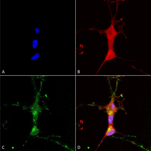 Immunocytochemistry/Immunofluorescence analysis using Mouse Anti-TrpC7 Monoclonal Antibody, Clone N64A/36 (STMA00101). Tissue: Neuroblastoma cells (SH-SY5Y). Species: Human. Fixation: 4% PFA for 15 min. Primary Antibody: Mouse Anti-TrpC7 Monoclonal Antibody (STMA00101) at 1:100 for overnight at 4°C with slow rocking. Secondary Antibody: AlexaFluor 488 at 1:1000 for 1 hour at RT.