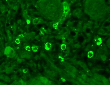 Immunohistochemistry analysis using Mouse Anti-GABA A Receptor Monoclonal Antibody, Clone N95/35 (STMA00104). Tissue: backskin. Species: Mouse. Fixation: Bouin's Fixative and paraffin-embedded. Primary Antibody: Mouse Anti-GABA A Receptor Monoclonal Antibody (STMA00104) at 1:100 for 1 hour at RT. Secondary Antibody: FITC Goat Anti-Mouse (green) at 1:50 for 1 hour at RT. Localization: Dermal Cells.