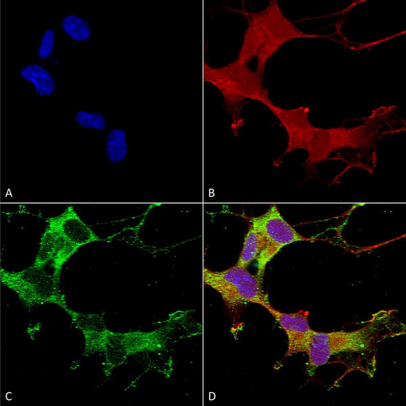 Immunocytochemistry/Immunofluorescence analysis using Mouse Anti-GABA-A Receptor Alpha-1 Monoclonal Antibody, Clone N95/35 (STMA00104). Tissue: Neuroblastoma cells (SH-SY5Y). Species: Human. Fixation: 4% PFA for 15 min. Primary Antibody: Mouse Anti-GABA-A Receptor Alpha-1 Monoclonal Antibody (STMA00104) at 1:50 for overnight at 4°C with slow rocking. Secondary Antibody: AlexaFluor 488 at 1:1000 for 1 hour at RT.