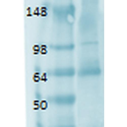 Western Blot analysis of Human thyroid lysate showing detection of Sodium Iodide Symporter protein using Mouse Anti-Sodium Iodide Symporter Monoclonal Antibody, Clone 14F (STMA00106). Primary Antibody: Mouse Anti-Sodium Iodide Symporter Monoclonal Antibody (STMA00106) at 1:1000.