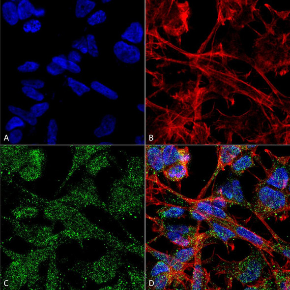 Immunocytochemistry/Immunofluorescence analysis using Mouse Anti-KCC2 Monoclonal Antibody, Clone N1/12 (STMA00107). Tissue: Neuroblastoma cell line (SK-N-BE). Species: Human. Fixation: 4% Formaldehyde for 15 min at RT. Primary Antibody: Mouse Anti-KCC2 Monoclonal Antibody (STMA00107) at 1:100 for 60 min at RT. Secondary Antibody: Goat Anti-Mouse ATTO 488 at 1:200 for 60 min at RT.