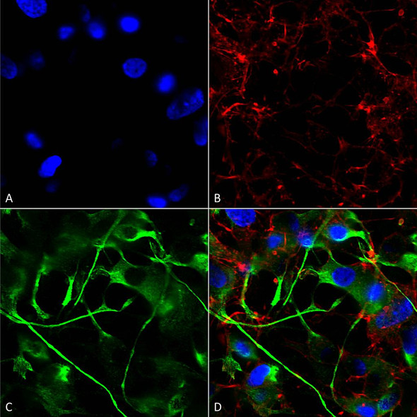 Immunocytochemistry/Immunofluorescence analysis using Mouse Anti-VAChT Monoclonal Antibody, Clone S6 (STMA00108). Tissue: Neuroblastoma cells (SH-SY5Y). Species: Human. Fixation: 4% PFA for 15 min. Primary Antibody: Mouse Anti-VAChT Monoclonal Antibody (STMA00108) at 1:200 for overnight at 4°C with slow rocking. Secondary Antibody: AlexaFluor 488 at 1:1000 for 1 hour at RT.