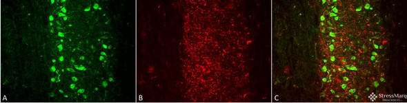 Immunohistochemistry analysis using Mouse Anti-VGLUT1 Monoclonal Antibody, Clone N28/9 (STMA00109). Tissue: spinal cord. Species: Mouse. Fixation: 4% PFA. Primary Antibody: Mouse Anti-VGLUT1 Monoclonal Antibody (STMA00109) at 1:500 for 16 hours at RT. Secondary Antibody: Alexa Fluor 555 Donkey Anti-Mouse (red) at 1:2000 for 2 hours at RT. Counterstain: NeuN neuronal stain (green). Magnification: 20X. Courtesy of: Leilei Wang, Ph.D.
