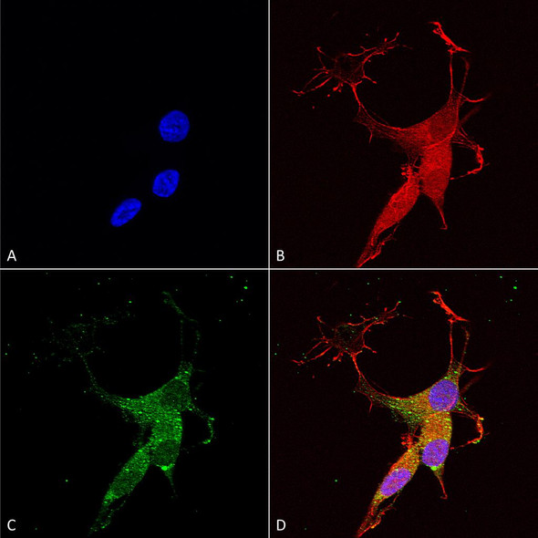 Immunocytochemistry/Immunofluorescence analysis using Mouse Anti-VGLUT3 Monoclonal Antibody, Clone N34/34 (STMA00112). Tissue: Neuroblastoma cells (SH-SY5Y). Species: Human. Fixation: 4% PFA for 15 min. Primary Antibody: Mouse Anti-VGLUT3 Monoclonal Antibody (STMA00112) at 1:50 for overnight at 4°C with slow rocking. Secondary Antibody: AlexaFluor 488 at 1:1000 for 1 hour at RT.