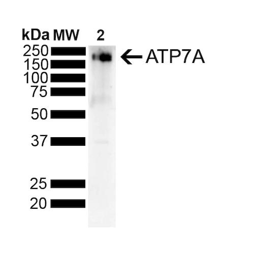 Western Blot analysis of Rat Liver showing detection of ~180 kDa Copper Transporting ATPase 1 protein using Mouse Anti-Copper Transporting ATPase 1 Monoclonal Antibody, Clone L60/4 (STMA00113). Lane 1: MW Ladder. Lane 2: Rat Liver. Load: 10 ug. Block: 5% Skim Milk powder in TBST. Primary Antibody: Mouse Anti-Copper Transporting ATPase 1 Monoclonal Antibody (STMA00113) at 1:500 for 2 hours at RT with shaking.