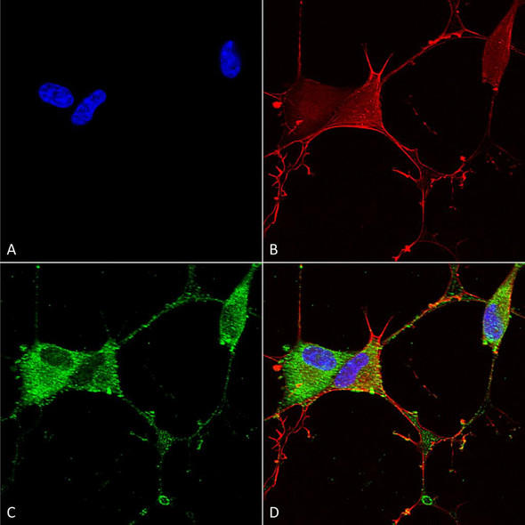 Immunocytochemistry/Immunofluorescence analysis using Mouse Anti-GABA-B Receptor 2 Monoclonal Antibody, Clone N81/2 (STMA00117). Tissue: Neuroblastoma cells (SH-SY5Y). Species: Human. Fixation: 4% PFA for 15 min. Primary Antibody: Mouse Anti-GABA-B Receptor 2 Monoclonal Antibody (STMA00117) at 1:100 for overnight at 4°C with slow rocking. Secondary Antibody: AlexaFluor 488 at 1:1000 for 1 hour at RT.
