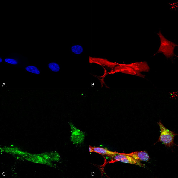 Immunocytochemistry/Immunofluorescence analysis using Mouse Anti-mGluR1/5 Monoclonal Antibody, Clone N75/33 (STMA00121). Tissue: Neuroblastoma cells (SH-SY5Y). Species: Human. Fixation: 4% PFA for 15 min. Primary Antibody: Mouse Anti-mGluR1/5 Monoclonal Antibody (STMA00121) at 1:100 for overnight at 4°C with slow rocking. Secondary Antibody: AlexaFluor 488 at 1:1000 for 1 hour at RT.