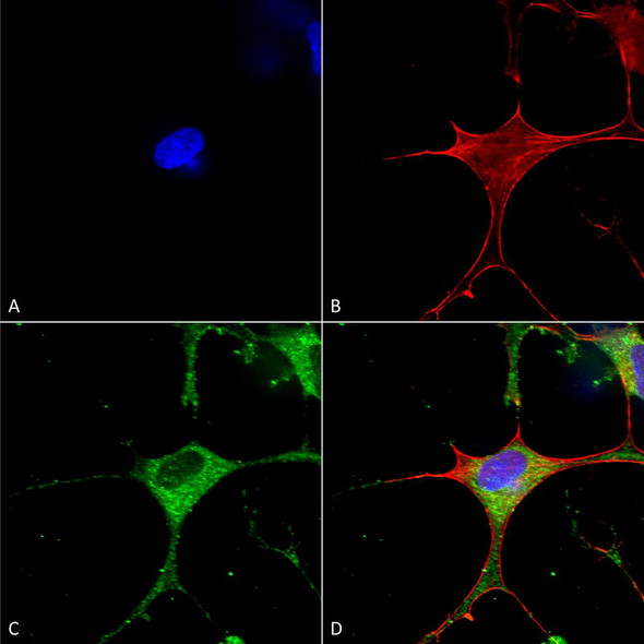 Immunocytochemistry/Immunofluorescence analysis using Mouse Anti-Clcn3 Monoclonal Antibody, Clone N258/5 (STMA00122). Tissue: Neuroblastoma cells (SH-SY5Y). Species: Human. Fixation: 4% PFA for 15 min. Primary Antibody: Mouse Anti-Clcn3 Monoclonal Antibody (STMA00122) at 1:50 for overnight at 4°C with slow rocking. Secondary Antibody: AlexaFluor 488 at 1:1000 for 1 hour at RT.