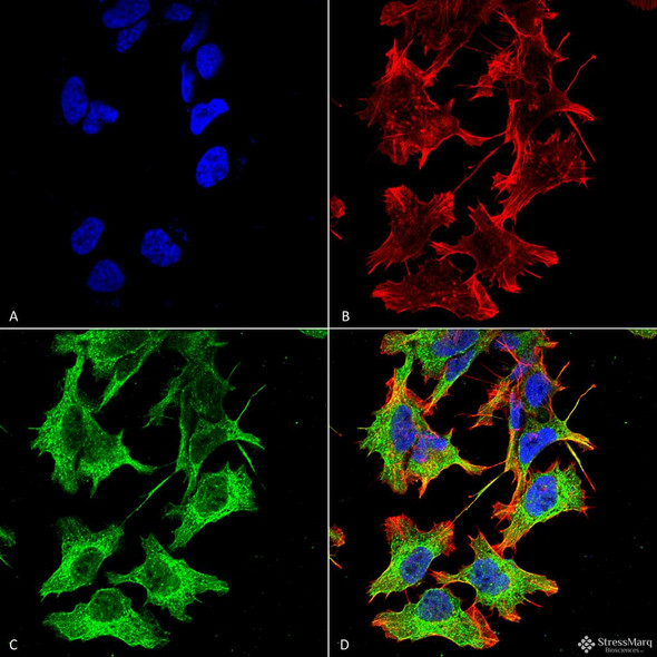 Immunocytochemistry/Immunofluorescence analysis using Mouse Anti-GluN1 Monoclonal Antibody, Clone N308/48 (STMA00124). Tissue: Neuroblastoma cell line (SK-N-BE). Species: Human. Fixation: 4% Formaldehyde for 15 min at RT. Primary Antibody: Mouse Anti-GluN1 Monoclonal Antibody (STMA00124) at 1:100 for 60 min at RT. Secondary Antibody: Goat Anti-Mouse ATTO 488 at 1:100 for 60 min at RT.