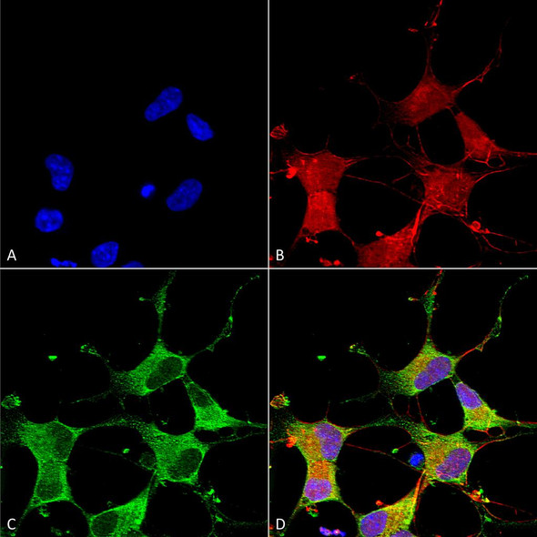 Immunocytochemistry/Immunofluorescence analysis using Mouse Anti-GIT1 Monoclonal Antibody, Clone N39B/8 (STMA00125). Tissue: Neuroblastoma cells (SH-SY5Y). Species: Human. Fixation: 4% PFA for 15 min. Primary Antibody: Mouse Anti-GIT1 Monoclonal Antibody (STMA00125) at 1:50 for overnight at 4°C with slow rocking. Secondary Antibody: AlexaFluor 488 at 1:1000 for 1 hour at RT.