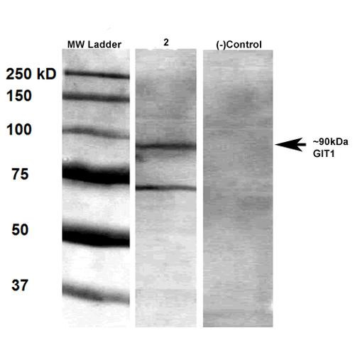 Western Blot analysis of Rat brain membrane lysate showing detection of GIT1 protein using Mouse Anti-GIT1 Monoclonal Antibody, Clone N39B/8 (STMA00125). Primary Antibody: Mouse Anti-GIT1 Monoclonal Antibody (STMA00125) at 1:1000.