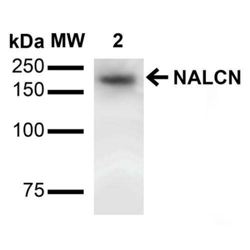 Western Blot analysis of Rat Brain showing detection of ~200 kDa NALCN protein using Mouse Anti-NALCN Monoclonal Antibody, Clone N187/7 (STMA00127). Lane 1: Molecular Weight (MW) Ladder. Lane 3: Rat Brain Membrane. Load: 15 µg. Block: 2% BSA and 2% Skim Milk in 1X TBST. Primary Antibody: Mouse Anti-NALCN Monoclonal Antibody (STMA00127) at 1:1000 for 16 hours at 4°C. Secondary Antibody: Goat Anti-Mouse IgG: HRP at 1:2000 for 60 min at RT.