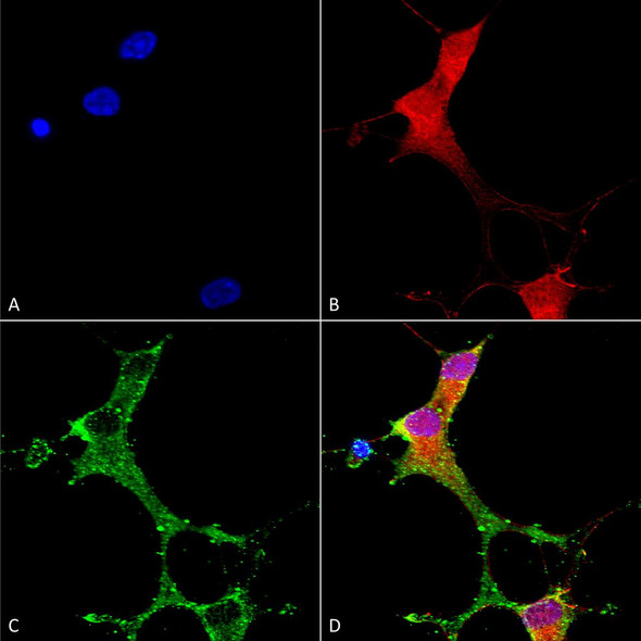 Immunocytochemistry/Immunofluorescence analysis using Mouse Anti-mGluR1/5 Monoclonal Antibody, Clone N75/3 (STMA00129). Tissue: Neuroblastoma cells (SH-SY5Y). Species: Human. Fixation: 4% PFA for 15 min. Primary Antibody: Mouse Anti-mGluR1/5 Monoclonal Antibody (STMA00129) at 1:50 for overnight at 4°C with slow rocking. Secondary Antibody: AlexaFluor 488 at 1:1000 for 1 hour at RT.