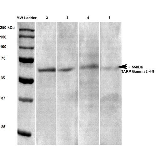 Western blot of rat brain lysate showing detection of ~55 kDa TARP Gamma2-4-8 protein using Anti-Tarp Gamma2-4-8 antibody [N245/36] (STMA00130). Lane 1: MW ladder. Lane 2: Anti-TARP Gamma2-4-8 (1:100). Lane 3: Anti-TARP Gamma2-4-8 (1:250). Lane 4: Anti-TARP Gamma2-4-8 (1:500). Lane 5: Anti-TARP Gamma2-4-8 (1:1000). Load: 20 µg RB lysate per lane. Block: 5% milk + TBST 1hr at RT.