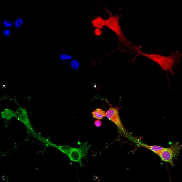 Immunocytochemistry/Immunofluorescence analysis using Mouse Anti-ASIC1 Monoclonal Antibody, Clone N271/44 (STMA00132). Tissue: Neuroblastoma cells (SH-SY5Y). Species: Human. Fixation: 4% PFA for 15 min. Primary Antibody: Mouse Anti-ASIC1 Monoclonal Antibody (STMA00132) at 1:100 for overnight at 4°C with slow rocking. Secondary Antibody: AlexaFluor 488 at 1:1000 for 1 hour at RT.
