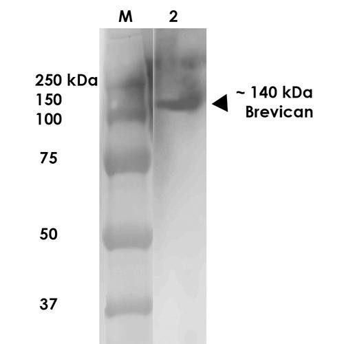 Western Blot analysis of Rat Brain Membrane showing detection of ~140 kDa Brevican protein using Mouse Anti-Brevican Monoclonal Antibody, Clone N294A/6 (STMA00133). Lane 1: MW Ladder. Lane 2: Rat Brain Membrane (10 µg). Load: 10 µg. Block: 5% milk. Primary Antibody: Mouse Anti-Brevican Monoclonal Antibody (STMA00133) at 1:1000 for 1 hour at RT. Secondary Antibody: Goat Anti-Mouse IgG: HRP at 1:200 for 1 hour at RT.