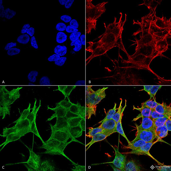 Immunocytochemistry/Immunofluorescence analysis using Mouse Anti-GluN2A Monoclonal Antibody, Clone N327/95 (STMA00134). Tissue: Neuroblastoma cell line (SK-N-BE). Species: Human. Fixation: 4% Formaldehyde for 15 min at RT. Primary Antibody: Mouse Anti-GluN2A Monoclonal Antibody (STMA00134) at 1:100 for 60 min at RT. Secondary Antibody: Goat Anti-Mouse ATTO 488 at 1:100 for 60 min at RT.